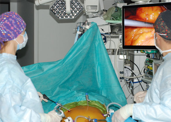 Лапароскопія